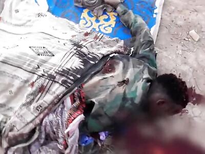 Attacked at the militia base in the city of Baidabo, Somalia