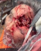 some difficulty on the road