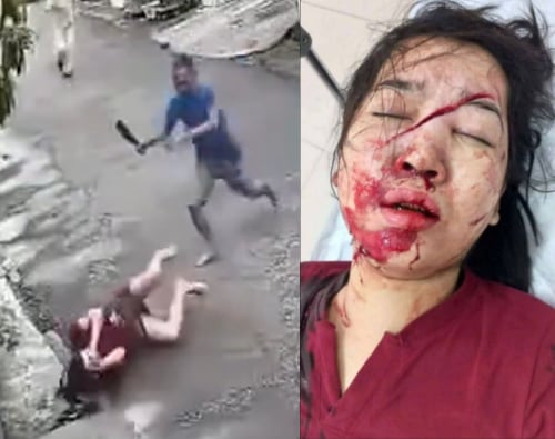 Young Woman Finds Out what a Sickle Feels Like