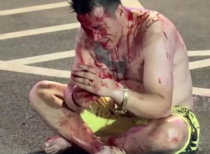 Dude Attacked, Face Slashed by Broken Bottle 