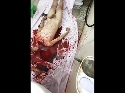 Man Hacks Off A Guy's Head With Meat Cleaver & Cooked Him [Dark Web Content]