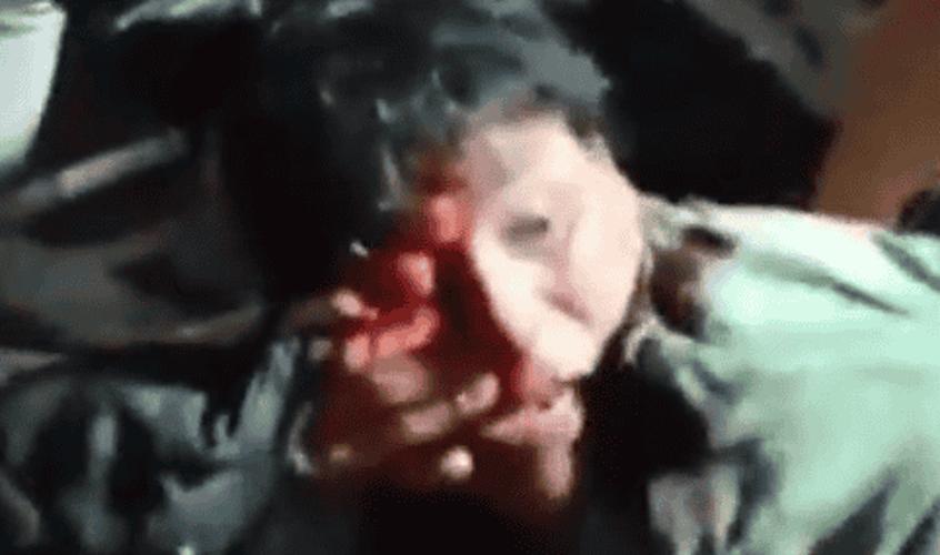 Man seriously injured during machete battle in Colombia