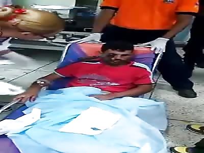  This man without anesthesia and not hurt as it removed