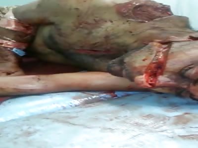 Man alive after brutal machete attack