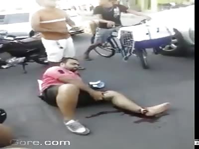 Compound Fracture and Dislocation of Ankle Due to Motorcycle Accident