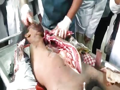 Most Shocking Autopsies