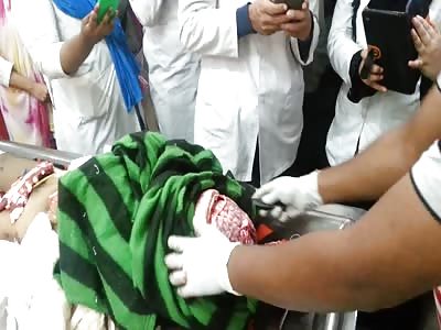 Postmortem procedure of opening of skull