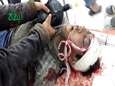 Wounded in critical condition