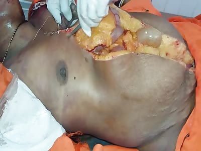 Postmortem of women dead body in civil hospital (Gruesome) 