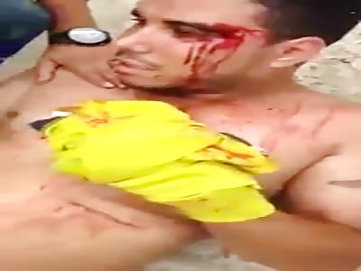 aftermath of machete attack