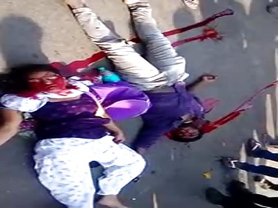 Young coupl Agonizing side by side in the road after brutal accident