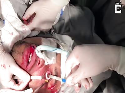 Gruesome Eyeball Surgery