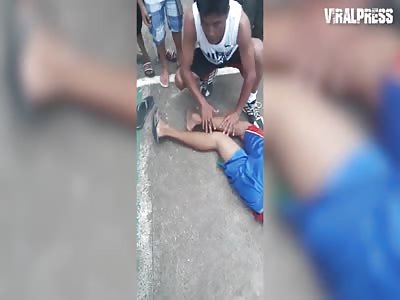 Teenager's Horrifying Basketball Injury