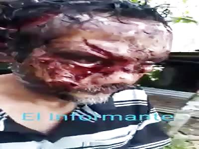 dog destroys face of drunk man