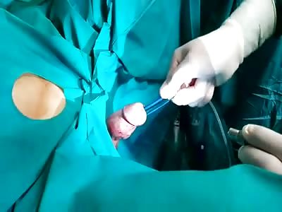 Guy gets toothbrush removed