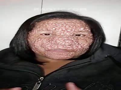 A flat shovel to the face would help! 