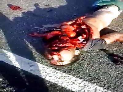 man totally fucked up in very brutal accident