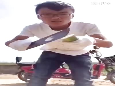 THAT'S GOING TO REQUIRE STITCHES