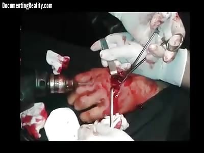 Just like building a deck, right...?