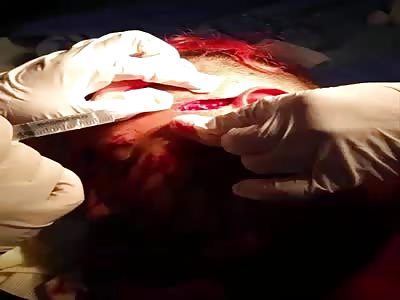 REAL WRESTLING INJURY