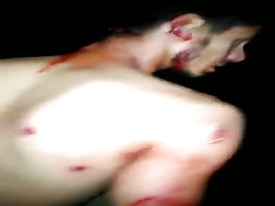 victim of police brutality in Venezuela