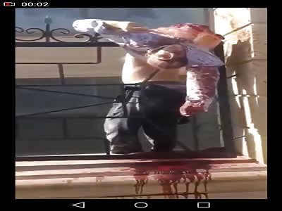 What a 9 Story Fall Does to Your Body