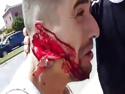 (SHOCKING) FACE SLASHED VERY DEEP