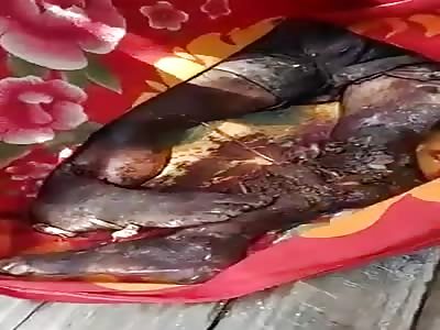 rotten dead body of young boy dead after mine explosions