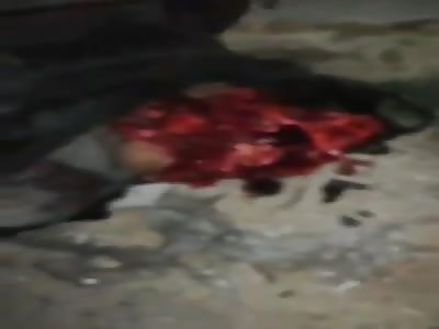 Blowing face of dead civilian after air strikes 