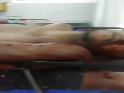 Dead corps of criminal killing by police