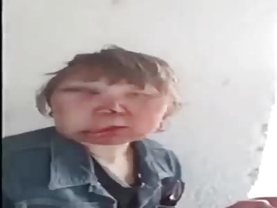 Russian woman face after drunk husband beating 