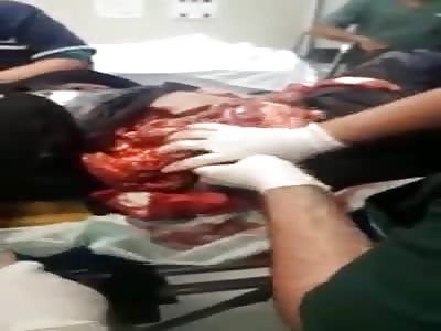 Guts Pouring Out of Dude... They can't Stuff Them in Fast Enough.