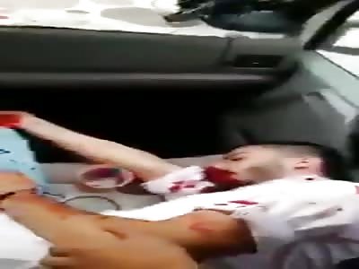 Syrian refugee stabbed by Turkish factory workers transported to hospi