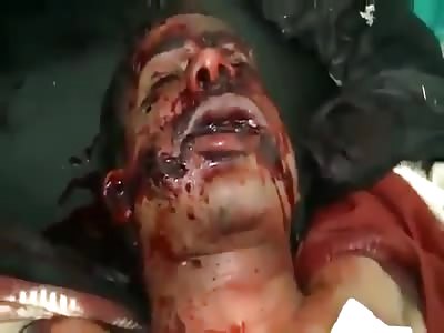 DEAD shattered body of Syrian man killed in regime airstrike 