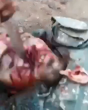 Azerbaijani Plunges a Knife Into Face of Armenian Soldier