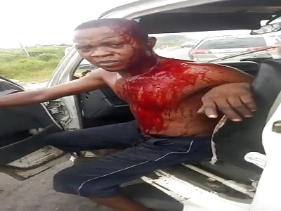 The man was beaten by army agents (Pt2).