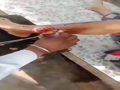 See how the Indian doctors is working