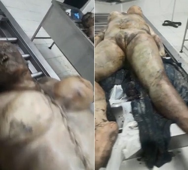 HANDSOME COUPLE LAYING IN THE MORGUE 