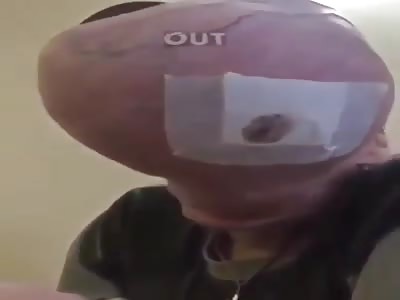 MAN WITH RARE DISEASE