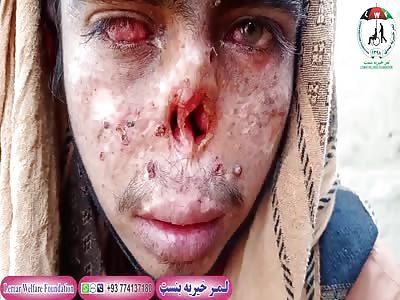 YOUNG MAN SUFFERS FROM SERIOUS ILLNESS