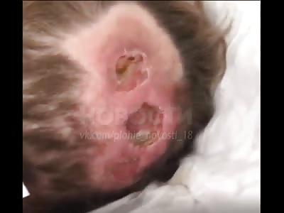 Russian woman suffer in very critical condition 