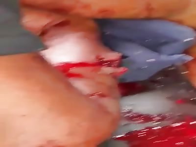 Riddled With Bullets By Narcos