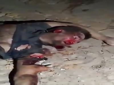 MAN VICTIM OF TERRIBLE ACCIDENT