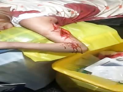 Woman stabbed by her husband 