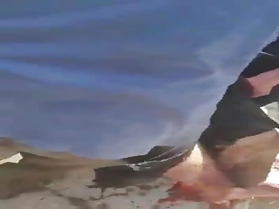 Shattered body of Syrian man after car bombing 