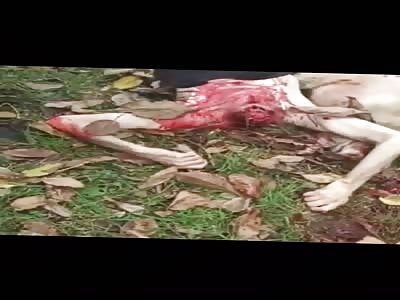 Short compilation of dead and butchered Armenian soldiers. 