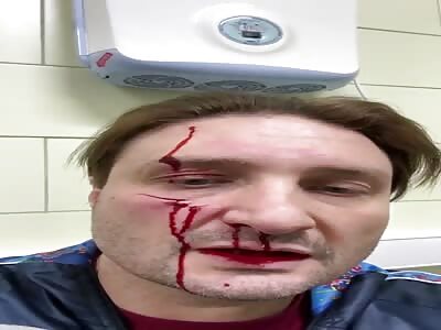 Aftermath of tiger attack his master face 