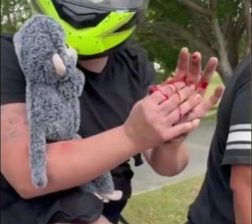 An attempt to detain car thieves, a woman lost a finger