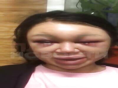 famous cosmetologist lost her beauty after her lover beat her 