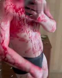 WTF: Stabbed by his Roommate While Sleeping